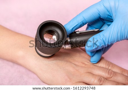Dermatoscopy skin examination. girl's hands. Royalty-Free Stock Photo #1612293748