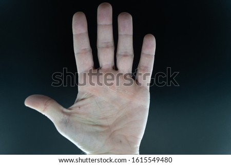 Calloused hands are portrayed with skin peeling Royalty-Free Stock Photo #1615549480