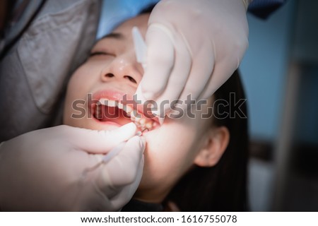 Dentist extracting teeth for young Asian woman Royalty-Free Stock Photo #1616755078