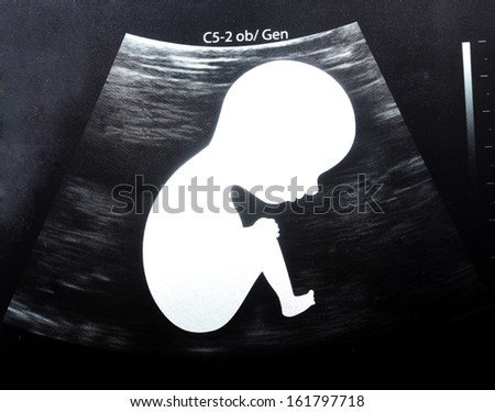 Close up Ultrasound Picture baby in mother womb