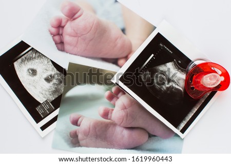 Two twins ultrasonogram pictures and photos of baby feet.