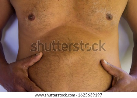 A man showing his epigastric hernia. Abdominal lump. Intestinal hernia.  Royalty-Free Stock Photo #1625639197