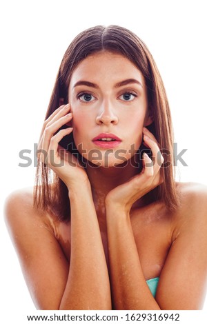 beautiful young brunette woman with vitiligo disease close up isolated on white positive smiling, model problems concept, bad tan real problem