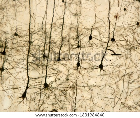 Pyramidal neurons of the cerebral cortex stained with the Golgi silver chromate. From the conic shaped soma, a large apical dendrite and multiple basal dendrites originate. Royalty-Free Stock Photo #1631964640
