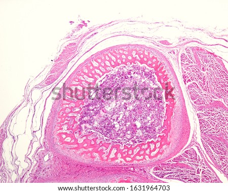 Low magnification micrograph showing a cross-sectioned immature bone. The periosteum surrounds the cortical of immature or primary woven bone tissue. The center material is the bone marrow. Royalty-Free Stock Photo #1631964703