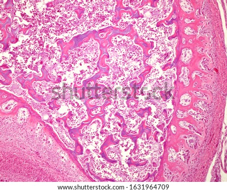 Cortical of immature or primary woven bone tissue. In the center, still remain some mixed trabeculae showing a bluish center of calcified cartilage, covered by bone tissue stained with eosin. Royalty-Free Stock Photo #1631964709