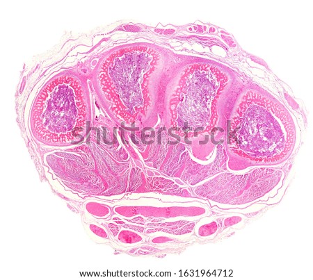 Very low magnification micrograph showing a cross-sectioned palm of an embryo hand. The metacarpals show a cortical of immature or primary woven bone tissue, formed by a network of bone trabeculae Royalty-Free Stock Photo #1631964712