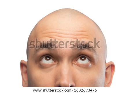 Image of bald man looking up, half head Royalty-Free Stock Photo #1632693475