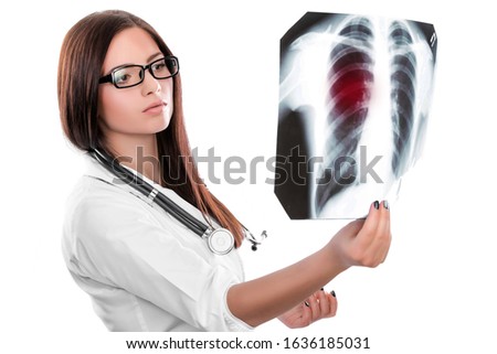 female doctor looking at the x-ray picture of lungs are damaged by Coronavirus, originating in Wuhan, China