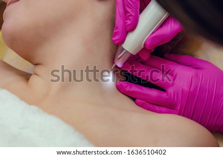 Removal of papillomas on the neck in a beauty salon.