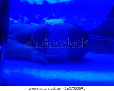 newborn baby with the blindfold sleep in the phototherapy lamp 