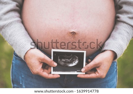 A pregnant woman is holding a photo of her baby, Ultrasound picture. outdoors .