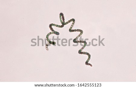 Spirulina algea has spiral  with abnormal shape under light-compound microscope