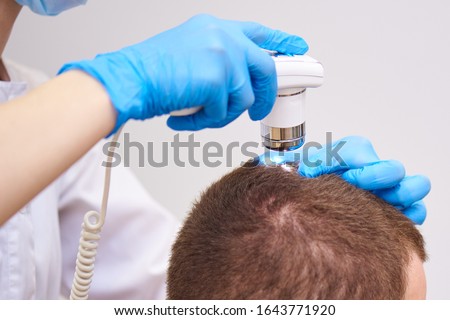Microscopic examination of the hair and skin of the scalp. Royalty-Free Stock Photo #1643771920