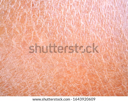 dry skin or ichthyosis texture detail in women using for moisturizer lotion, cream or beauty product concept, motion blur and macro shot photo. Royalty-Free Stock Photo #1643920609