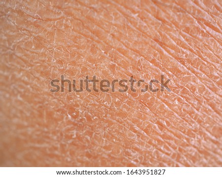 dry skin or ichthyosis texture detail in women using for moisturizer lotion, cream or beauty product concept, motion blur and macro shot photo. Royalty-Free Stock Photo #1643951827