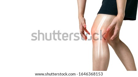Human leg Osteoarthritis inflammation of bone joints on white background Royalty-Free Stock Photo #1646368153