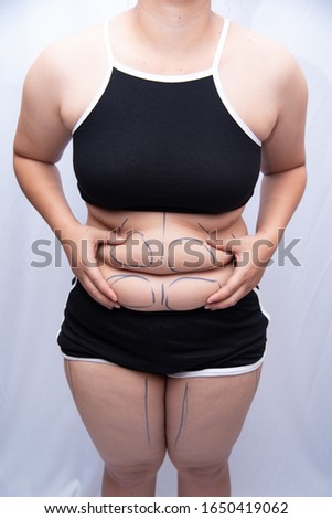 A beautiful fat woman with a tape measure, using her hands to squeeze the excess fat isolated on a white background. She wants to lose weight, the concept of surgery and dissolve fat under wearing a b