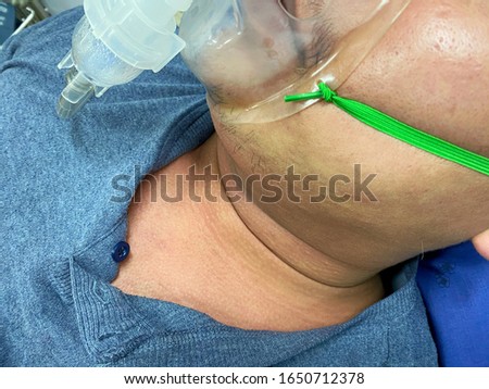 Man nebulizer due to allergies and skin rash.