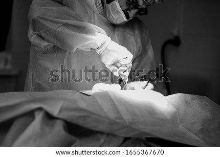 Surgeon performing surgery on breasts in hospital operating room. Surgeon in mask wearing surgical loupes during medical procedure.