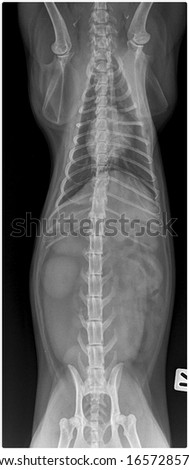 x ray normal chest abdominal and pelvic cat front view 