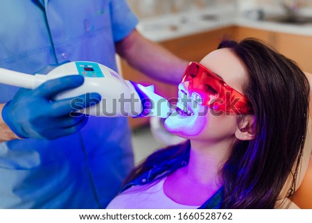 Teeth whitening for woman. Bleaching of the teeth at dentist clinic. Royalty-Free Stock Photo #1660528762