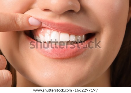 Young woman with healthy gums, closeup Royalty-Free Stock Photo #1662297199