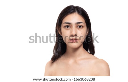 Beautiful asian woman get freckles, blemish, pimple or acne, dull skin, scar on beauty face. Charming beautiful young woman get problems of her skin. She looks unhappy. isolated on white, copy space