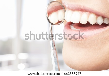 Teeth health concept. Smiling woman mouth under treatment at dental clinic Royalty-Free Stock Photo #1663355947