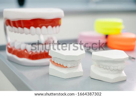 Dental casting gypsum model of jaws, orthodontic bands, orthodontist's office equipment.