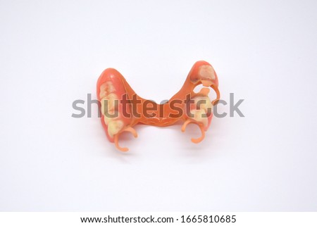 Removable partial dentures of the upper and lower jaw