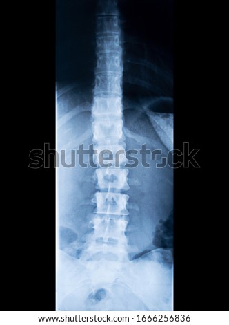 X-ray of human spinal column isolated on black