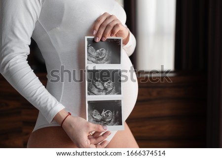 A young pregnant girl is holding a picture of an ultrasound near her abdomen. The concept of a healthy pregnancy.