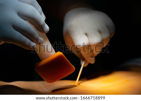 Assistant surgeon disinfects the abdomen prior to the surgery, following aseptic technique. Royalty-Free Stock Photo #1666718899