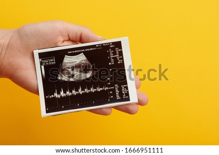 Ultrasound photo of future baby in woman hand close up view Royalty-Free Stock Photo #1666951111