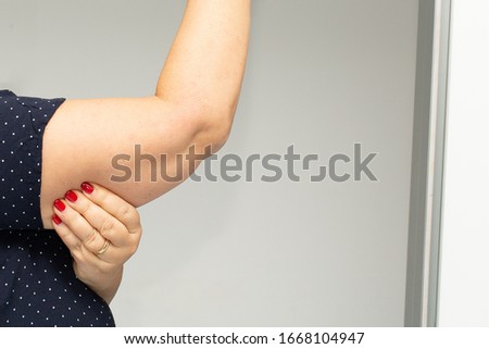 Fatty tissue in the arms of a middle aged overweight lady Royalty-Free Stock Photo #1668104947