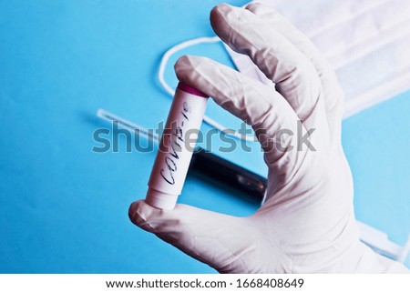 The fight against coronavirus. Dangerous coronavirus from China is spreading by Europe. Test tube for coronavirus test in patient. The doctor holds in his hands a medical tube. Coronavirus