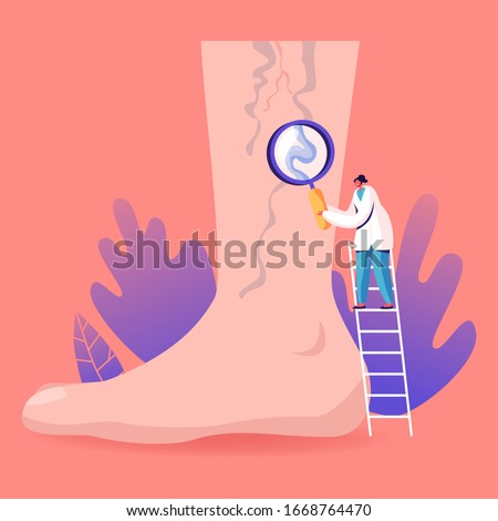 Vein Thrombosis and Varicose Treatment Concept. Tiny Doctor Character Stand on Ladder with Magnifying Glass Looking on Huge Foot with Diseased Veins. Health Care, Podiatry. Cartoon Vector Illustration Royalty-Free Stock Photo #1668764470