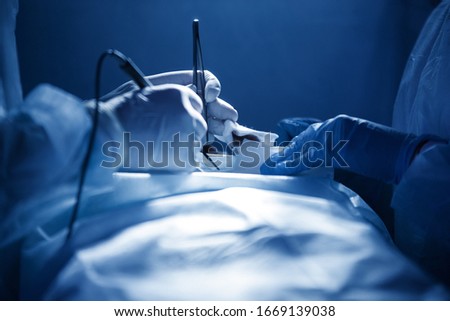 Hands of the surgeon during the operation in latex gloves, blue uniform of doctors. Bipolar coagulation. Close-up. Spot lighting. Royalty-Free Stock Photo #1669139038