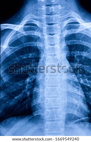 Thoracic and abdominal cavity X-ray film