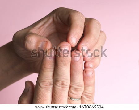 White spots on the nails of the male hand caused by a deficiency of calcium, zinc or poisoning by household chemicals on a pink background. This disease is called leukonychia.
