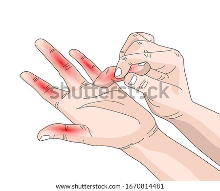 Clip art vector illustration doodle drawing of body people with hand pain, joint, bone of finger and numbness in fingertips. Rheumatoid arthritis.
