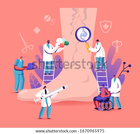Vein Thrombosis and Varicose Treatment Concept. Tiny Doctor Characters with Medical Instruments and Drugs around of Huge Foot with Diseased Veins, Health Care. Cartoon People Vector Illustration Royalty-Free Stock Photo #1670965975