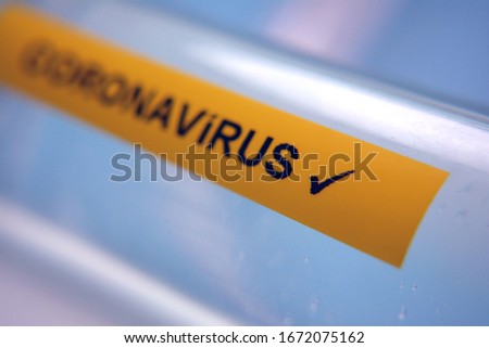 Yellow label with positive virus description, medicine