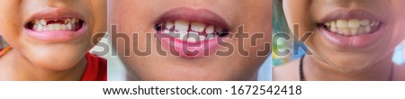 Many pictures of the teeth and gums of the child are deformed and many problems are unattractive.