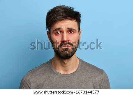 Miserable displeased man has sick look, red swollen eyes, smirks face, suffers from conjunctivitis, seasonal allergy, poses against blue background. People, disease, health problems concept. Royalty-Free Stock Photo #1673144377