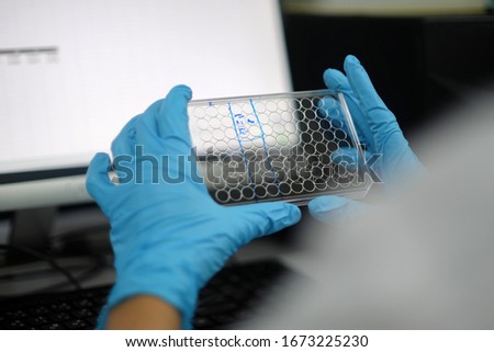 Soft focus of Scientific experiments in the lab,Experimental vaccine for disease treatment,Invented antiretroviral drugs