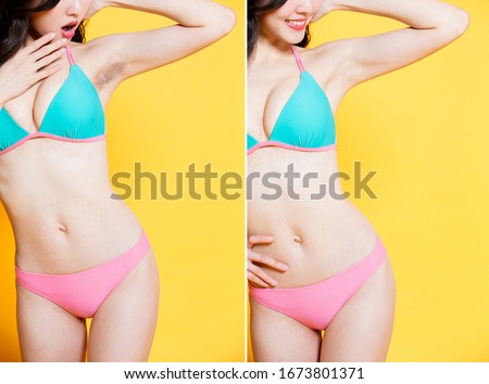 asia beauty woman wear bikini with armpit hair removal problem - before and after concept