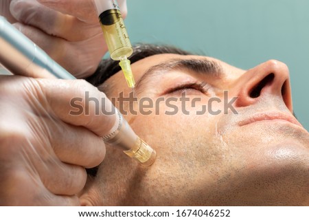 Macro close up of therapist injecting enzymes on cheek with derma pen of middle aged man. Royalty-Free Stock Photo #1674046252