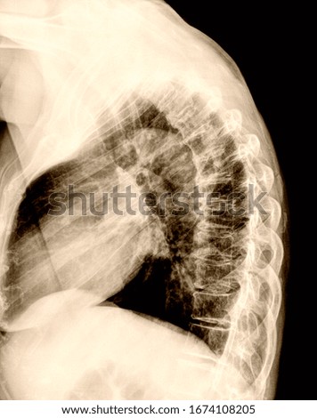 Spine and pelvis of a human body on x-ray.